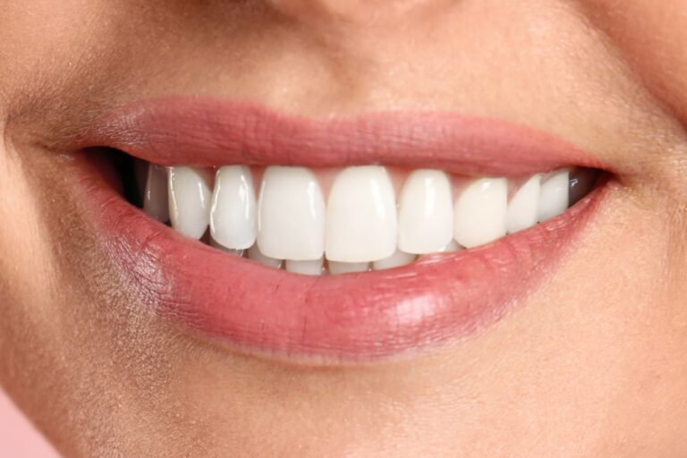 After Dental treatment