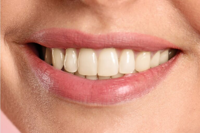 Before Dental treatment