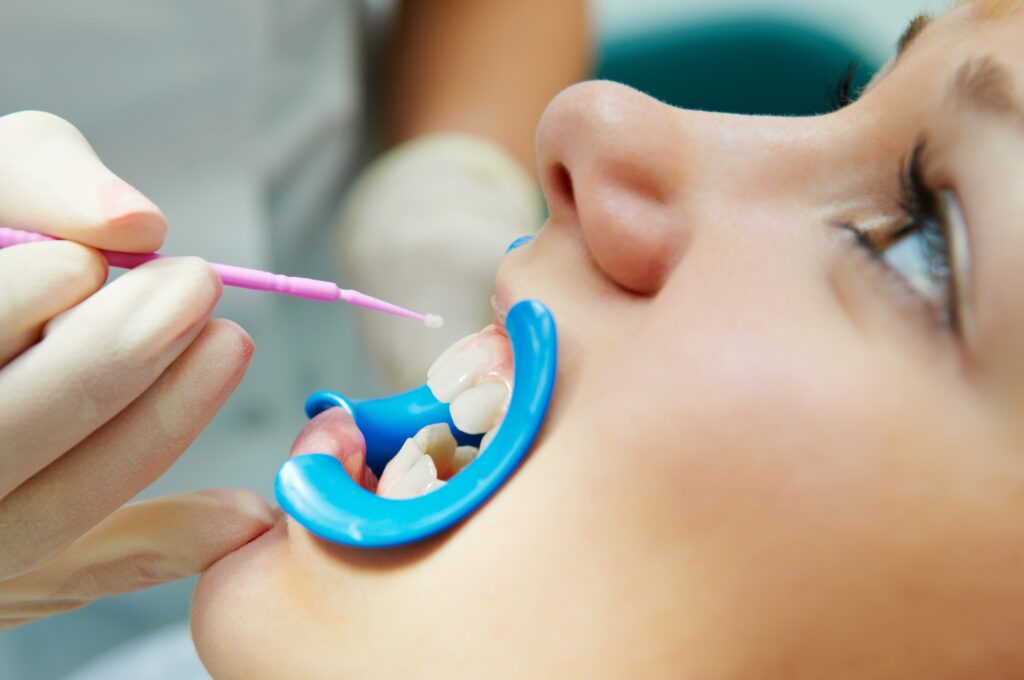 woman with open mouth during dental procedure of teeth